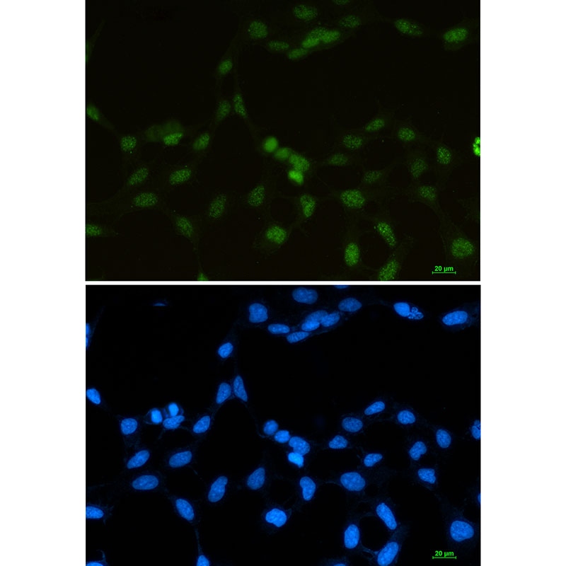 Rabbit Monoclonal Antibody to hnRNP G