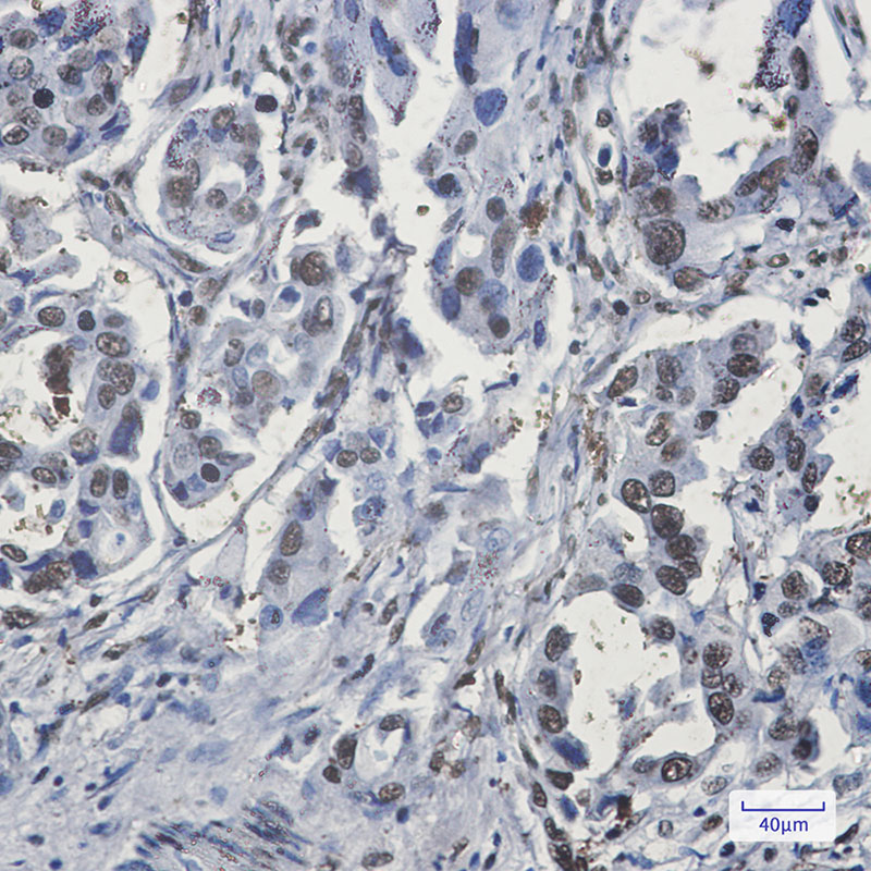 Rabbit Monoclonal Antibody to hnRNP G