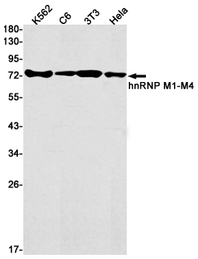 hnRNP M