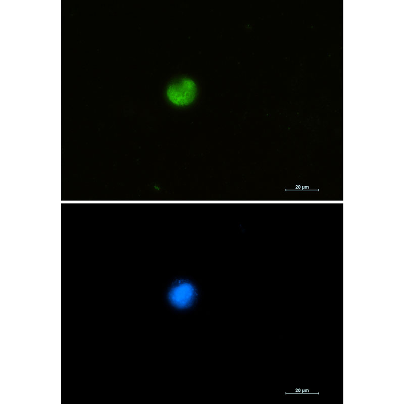 Rabbit Monoclonal Antibody to hnRNP M