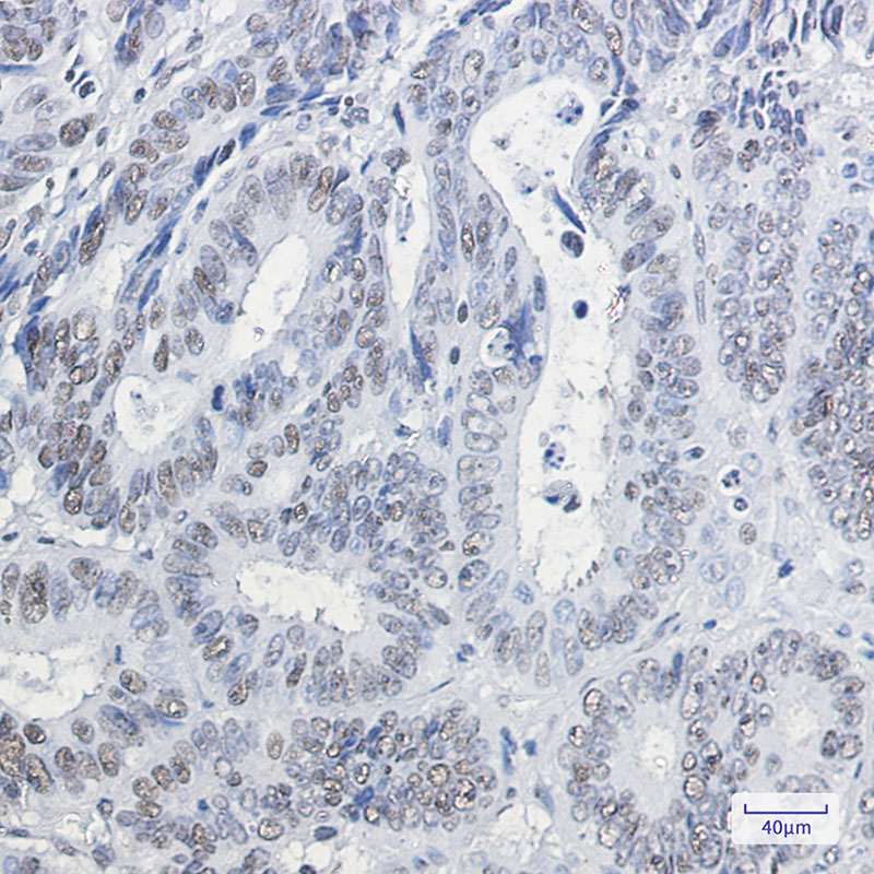 Rabbit Monoclonal Antibody to HP1 gamma