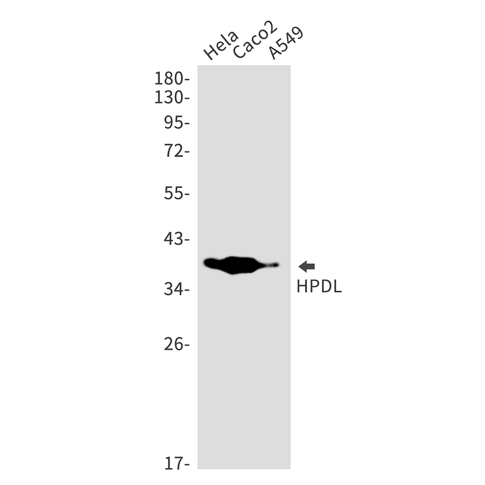 HPDL