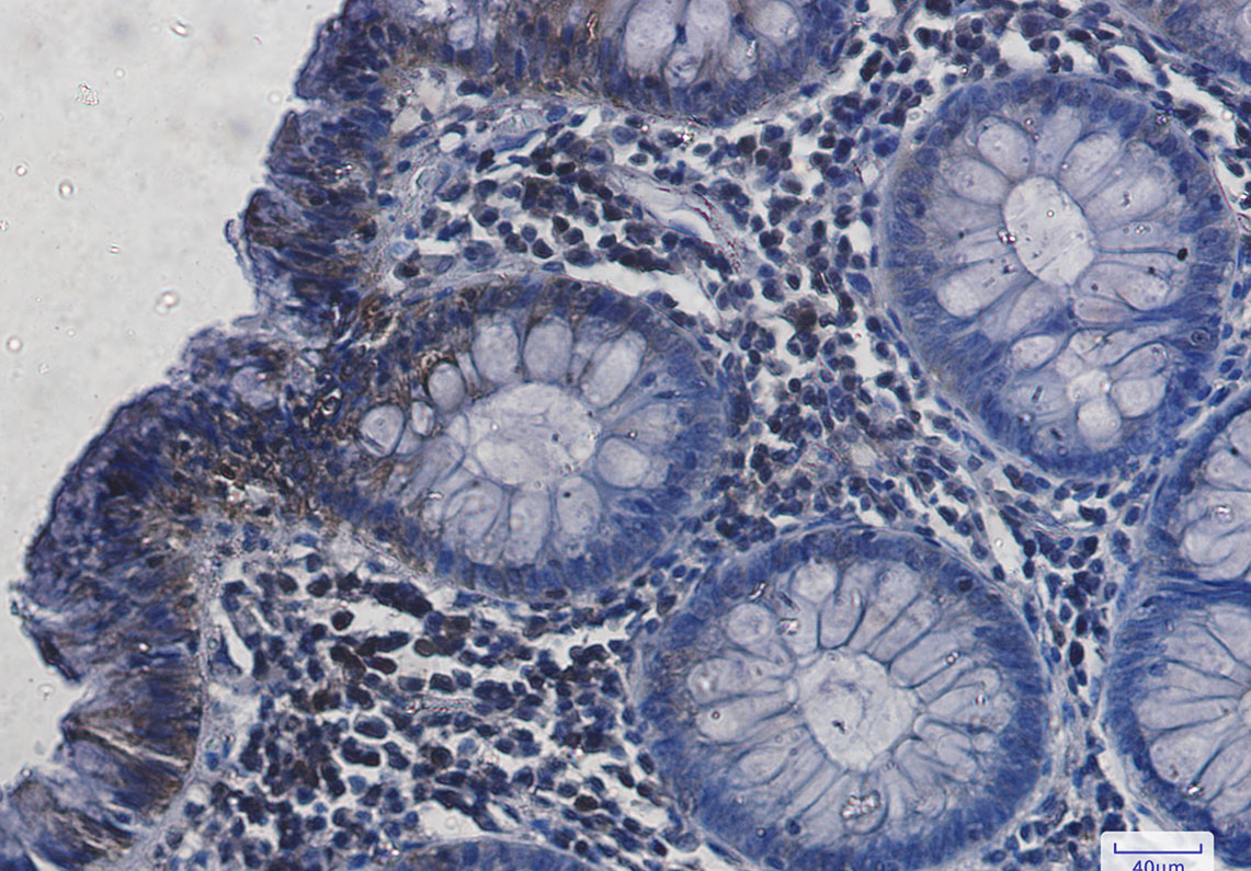 Rabbit Monoclonal Antibody to Hsc70