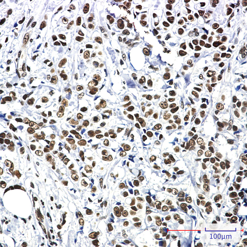 Rabbit Monoclonal Antibody to Hsf1