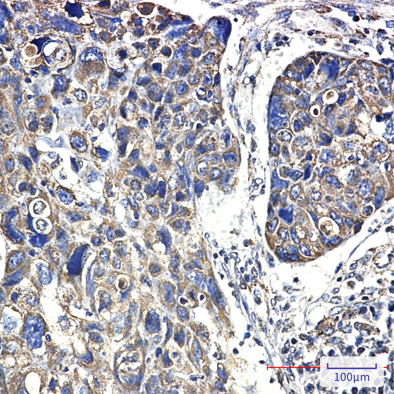 Rabbit Monoclonal Antibody to Hsp60