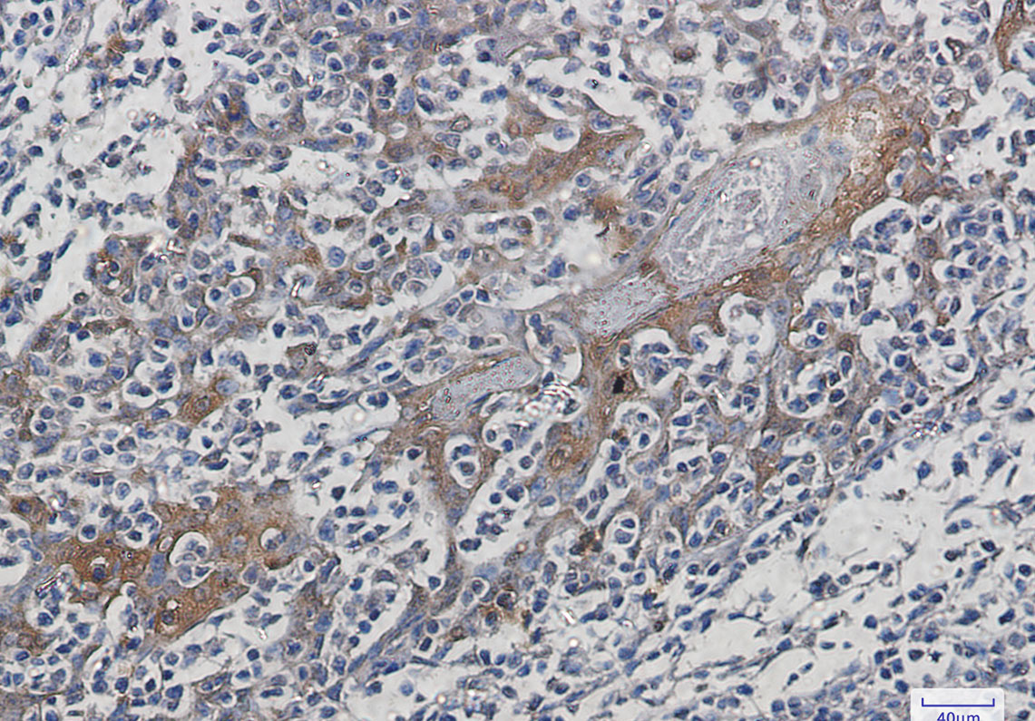 Rabbit Monoclonal Antibody to Hsp70