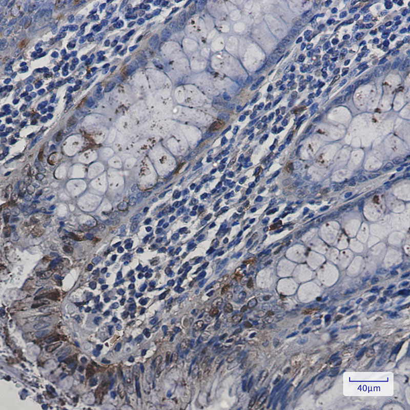 Rabbit Monoclonal Antibody to HspA2