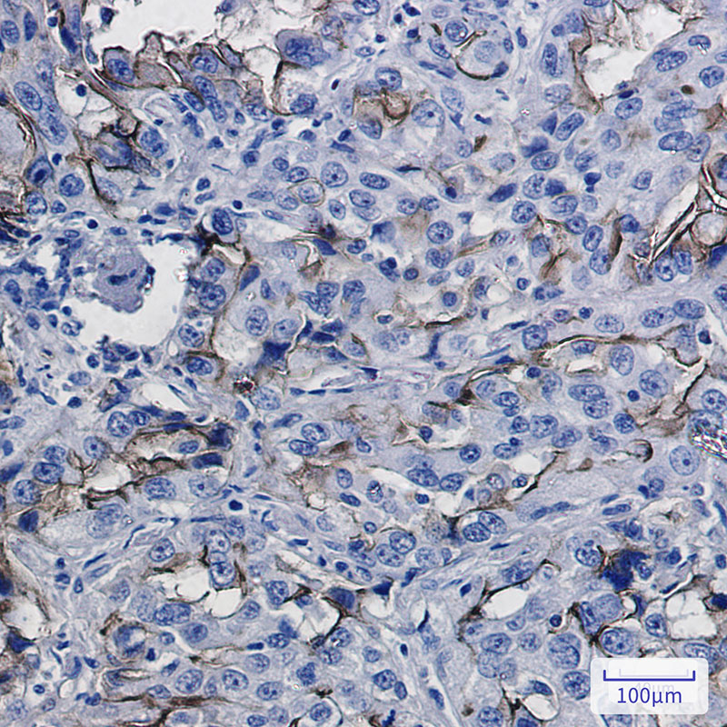 Rabbit Monoclonal Antibody to ICAM1