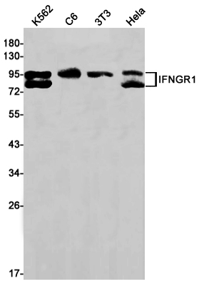 Interferon gamma Receptor 1