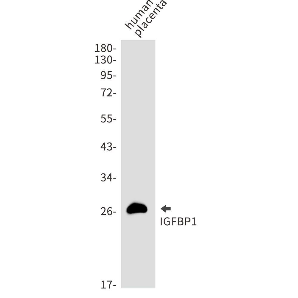 IGFBP1