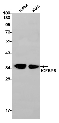 IGFBP6