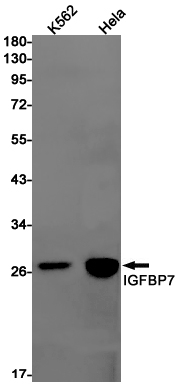 IGFBP7