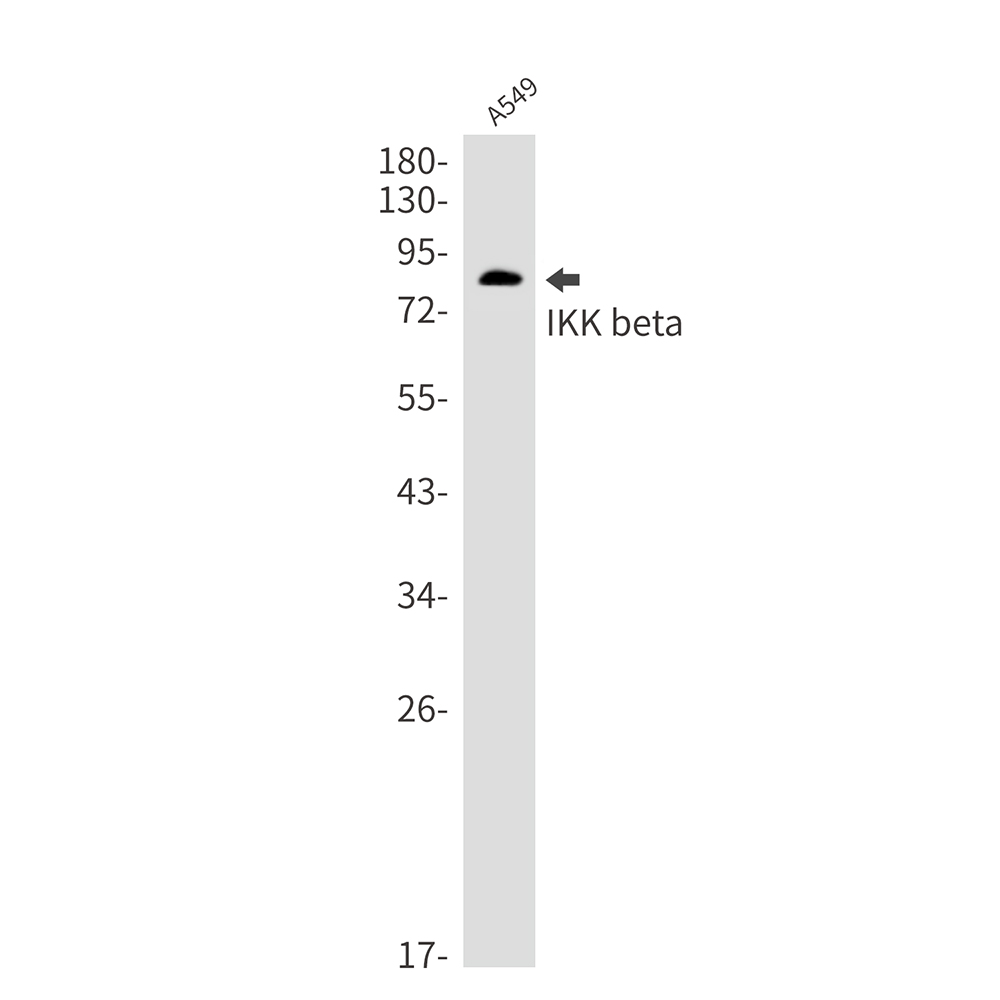 IKK beta