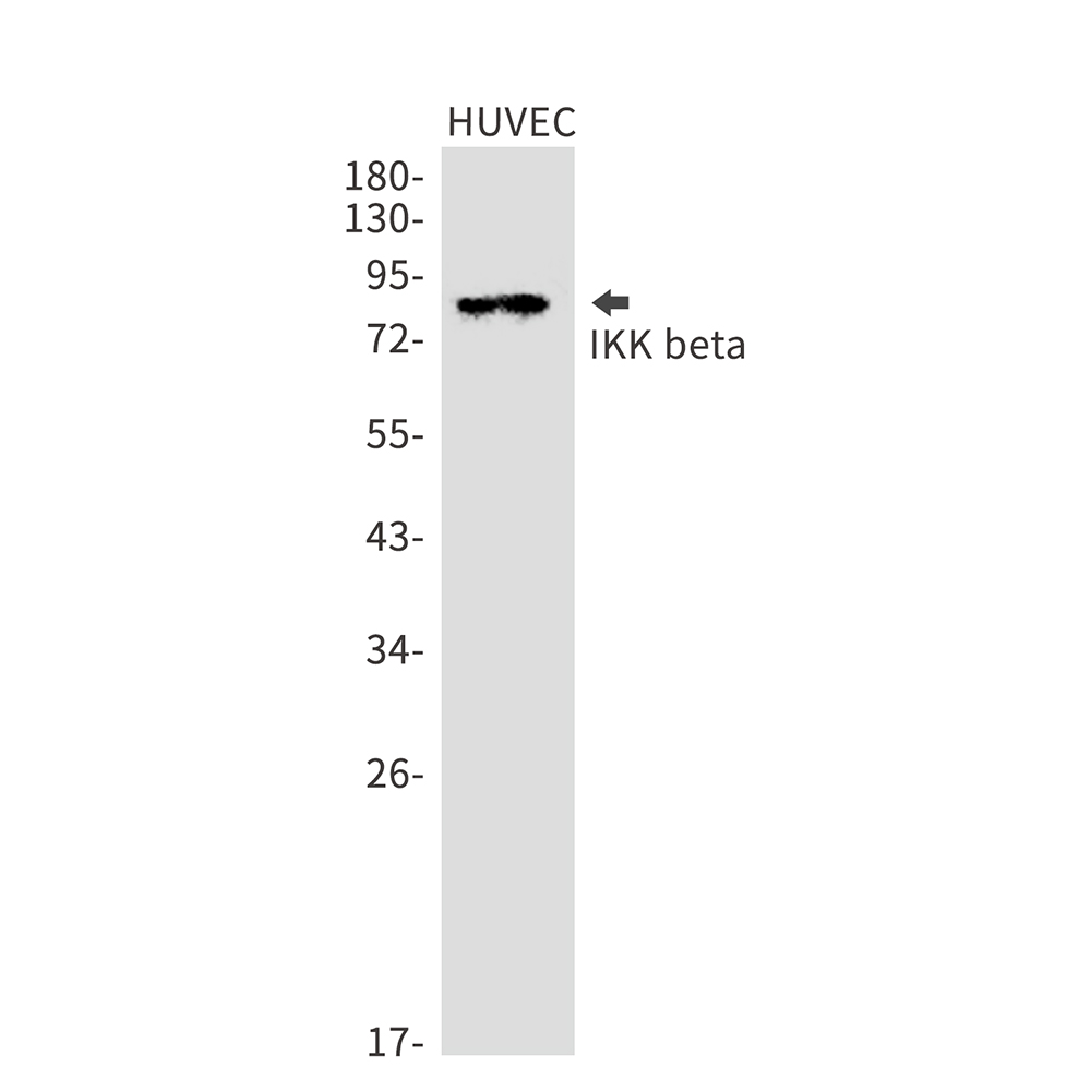 IKK beta