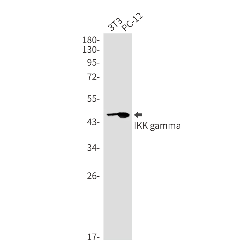 IKK gamma