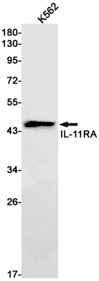 IL-11 Receptor alpha