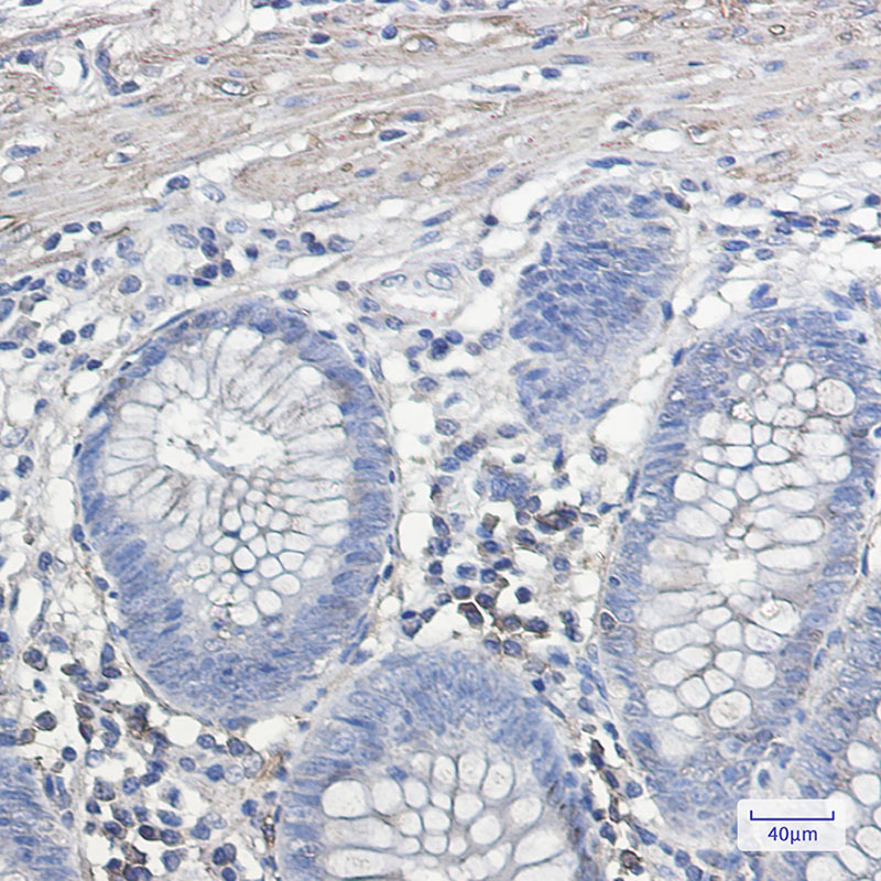 Rabbit Monoclonal Antibody to IL-11 Receptor alpha