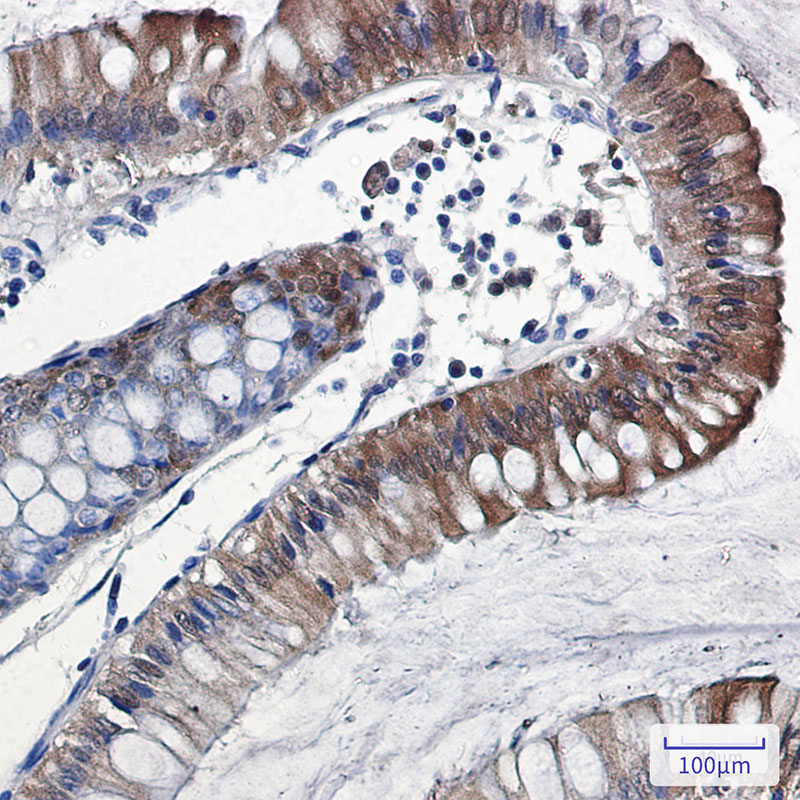 Rabbit Monoclonal Antibody to IL-18