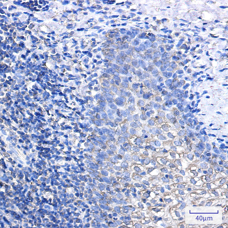 Rabbit Monoclonal Antibody to IL-1 Receptor Antagonist Protein