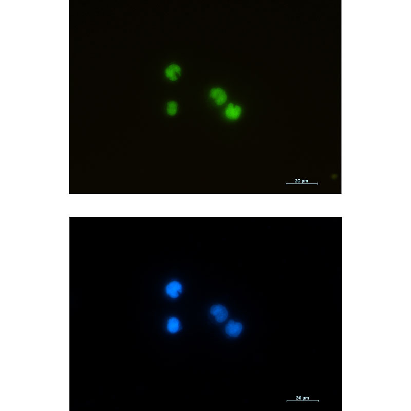 Rabbit Monoclonal Antibody to ILF3