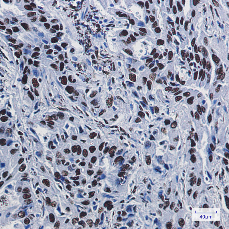 Rabbit Monoclonal Antibody to ILF3