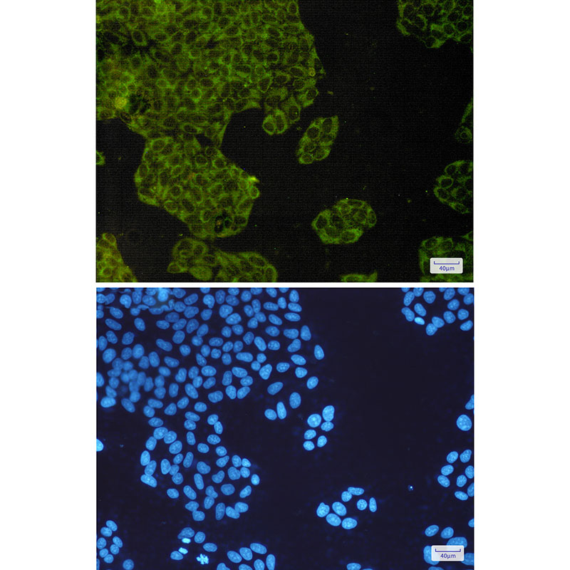 Rabbit Monoclonal Antibody to IMP3