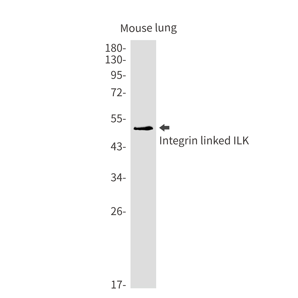 Integrin Linked ILK