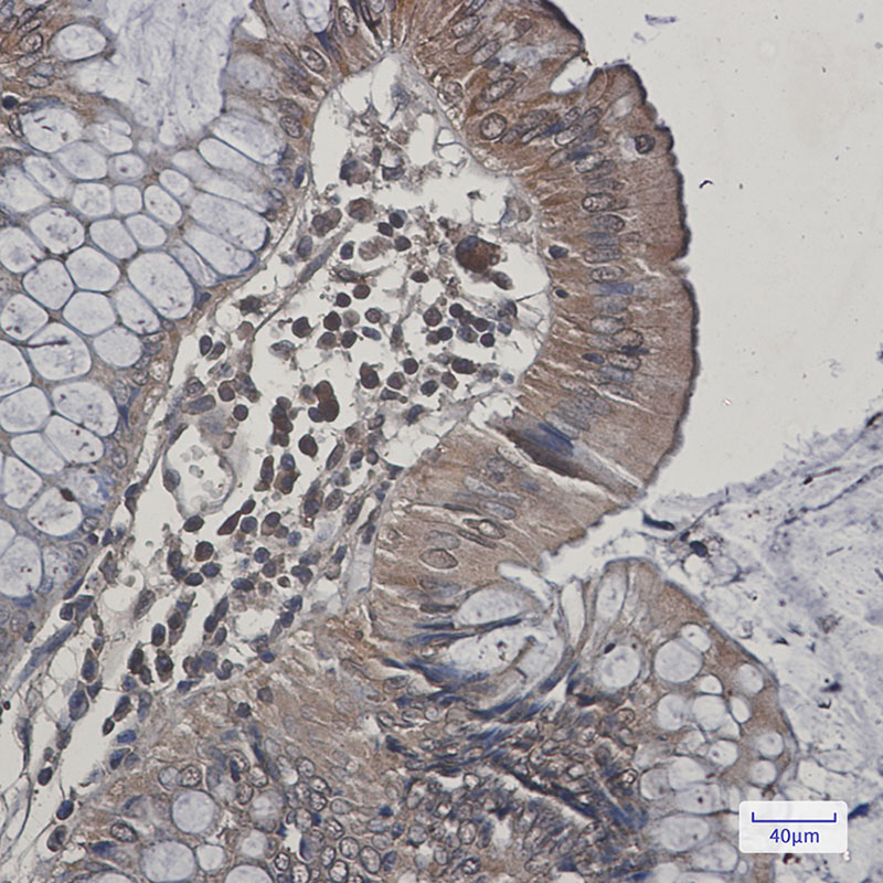 Rabbit Monoclonal Antibody to JNK2