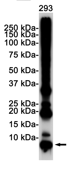 Rabbit Monoclonal Antibody to Ubiquitin K48