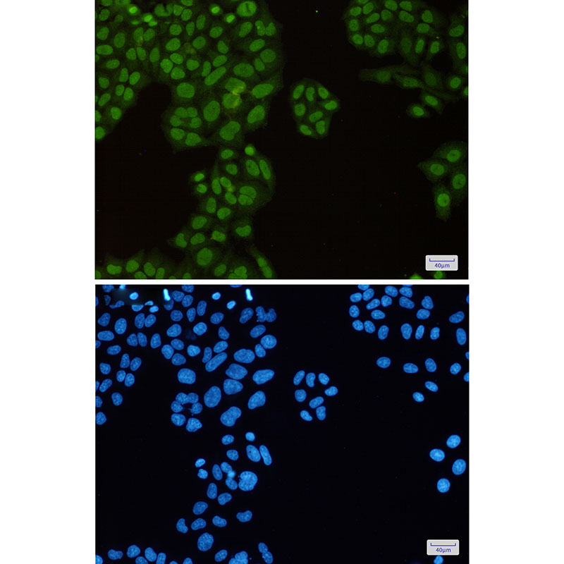 Rabbit Monoclonal Antibody to KAP1