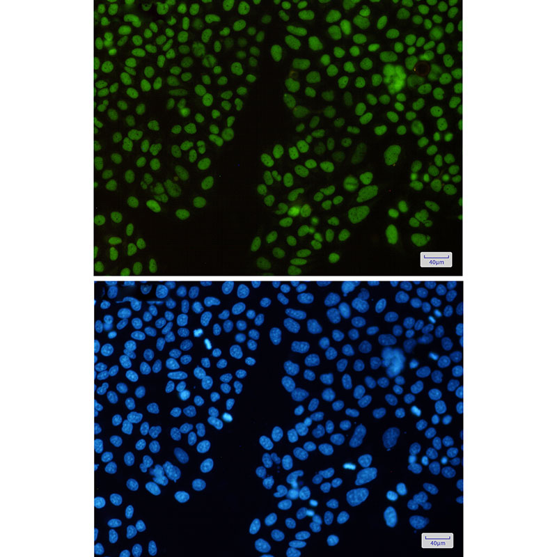 Rabbit Monoclonal Antibody to KAT1