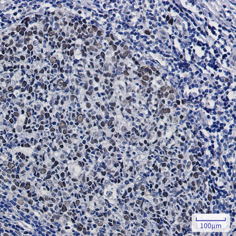 Rabbit Monoclonal Antibody to KAT1