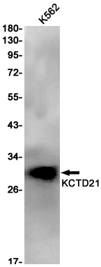 Rabbit Monoclonal Antibody to KCTD21