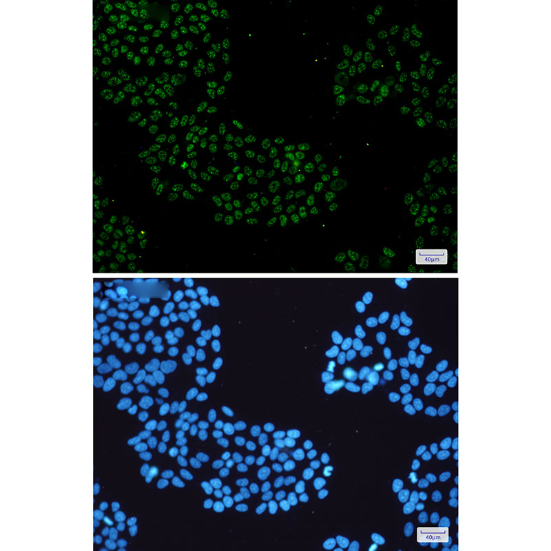 Rabbit Monoclonal Antibody to KDM1A