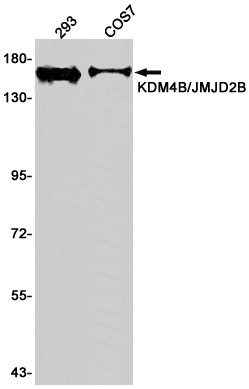 KDM4B