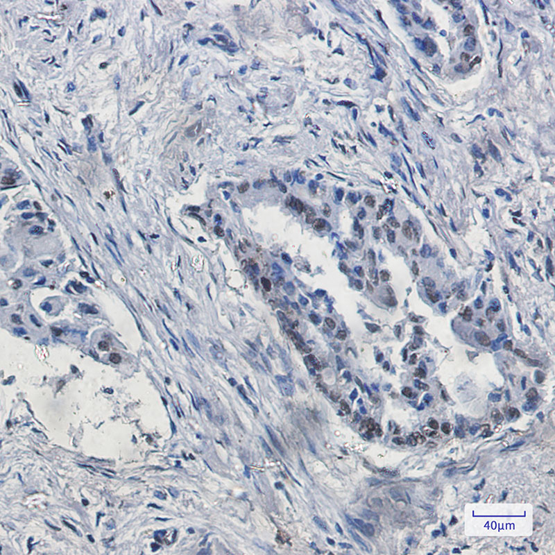 Rabbit Monoclonal Antibody to KDM4B