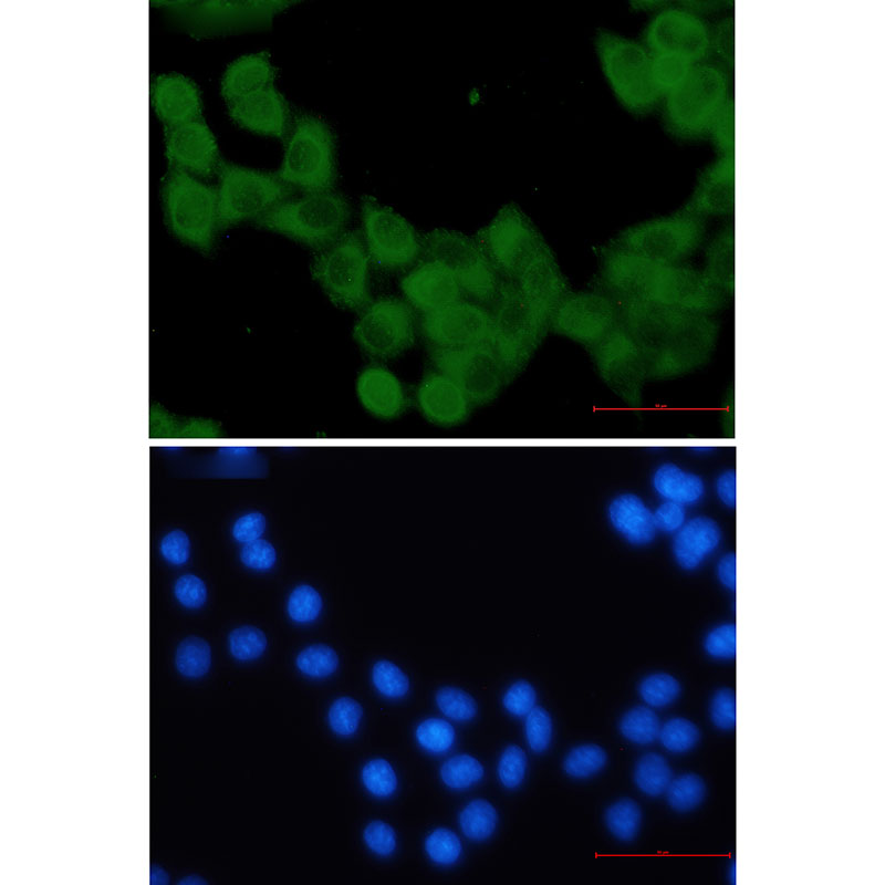 Rabbit Monoclonal Antibody to KIF5B