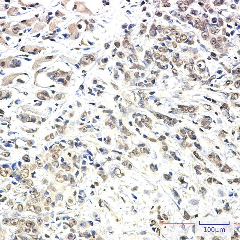 Rabbit Monoclonal Antibody to KIF5B
