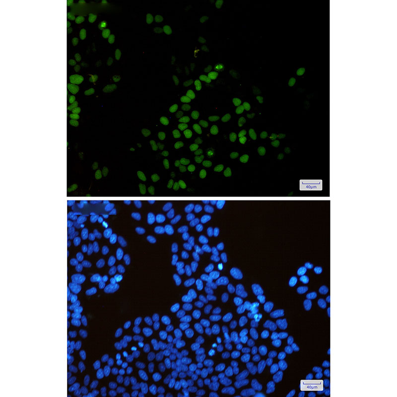 Rabbit Monoclonal Antibody to KIFC1