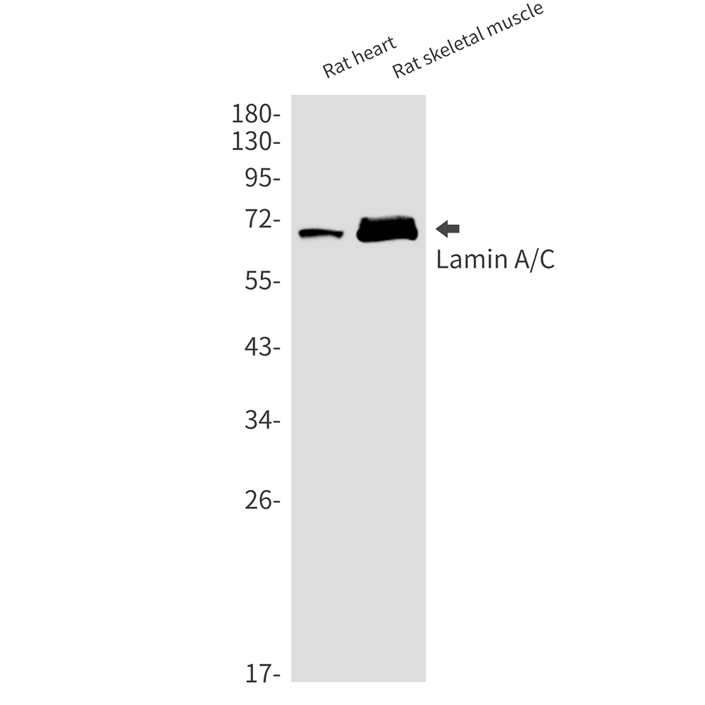 Lamin A/C