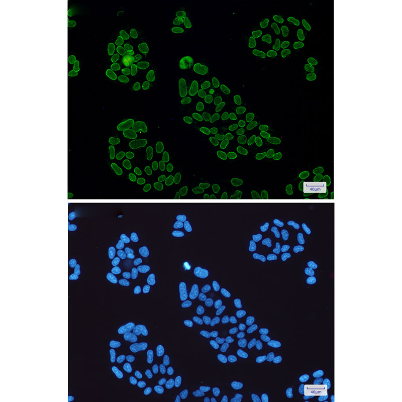 Rabbit Monoclonal Antibody to Lamin A/C