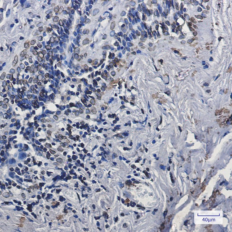 Rabbit Monoclonal Antibody to Lamin A/C
