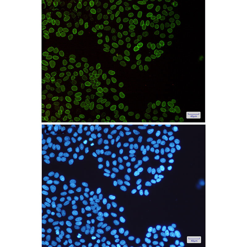 Rabbit Monoclonal Antibody to Lamin B2