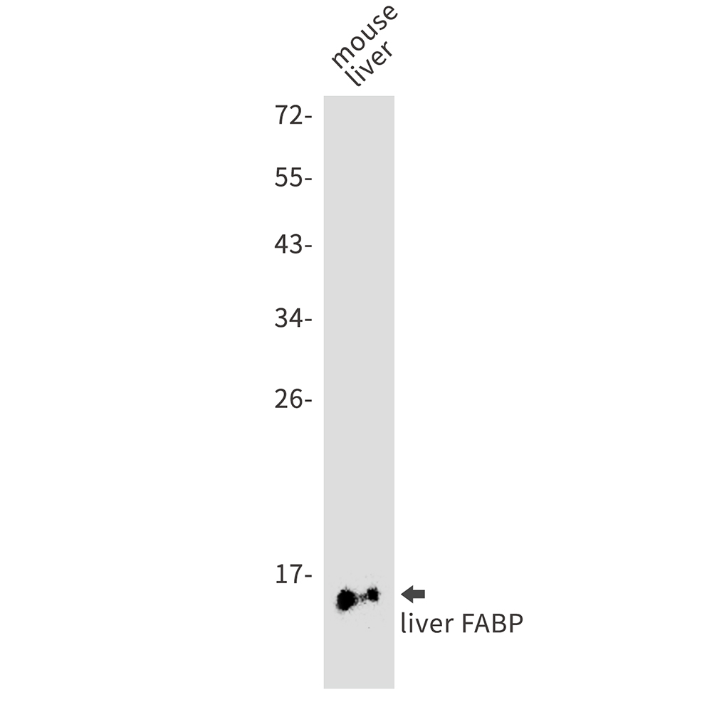 FABP1