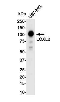 LOXL2