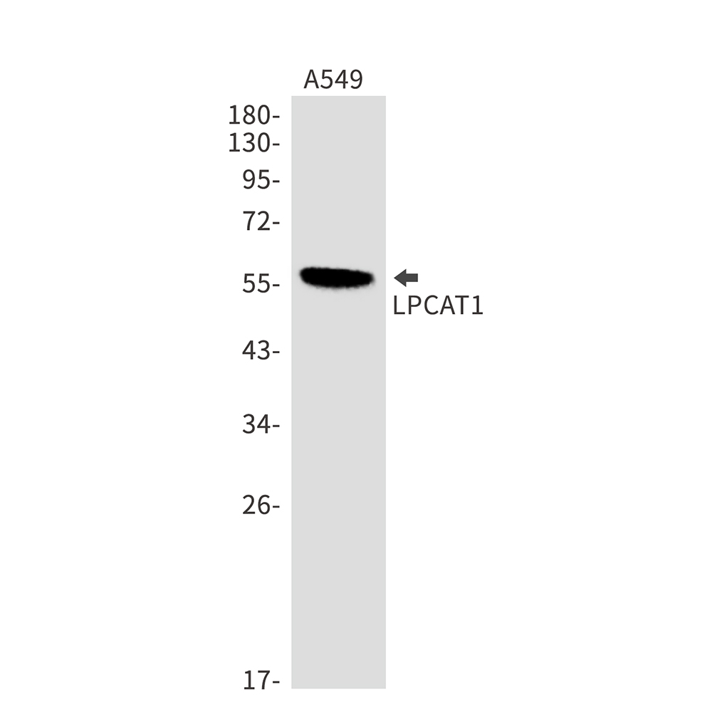 LPCAT1