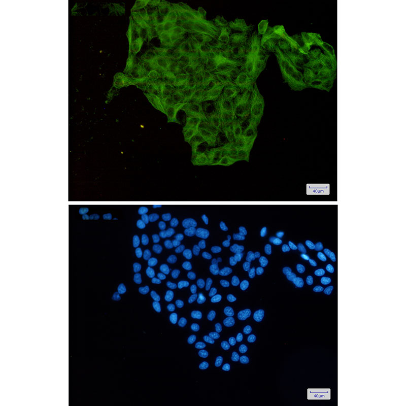 Rabbit Monoclonal Antibody to Lumican
