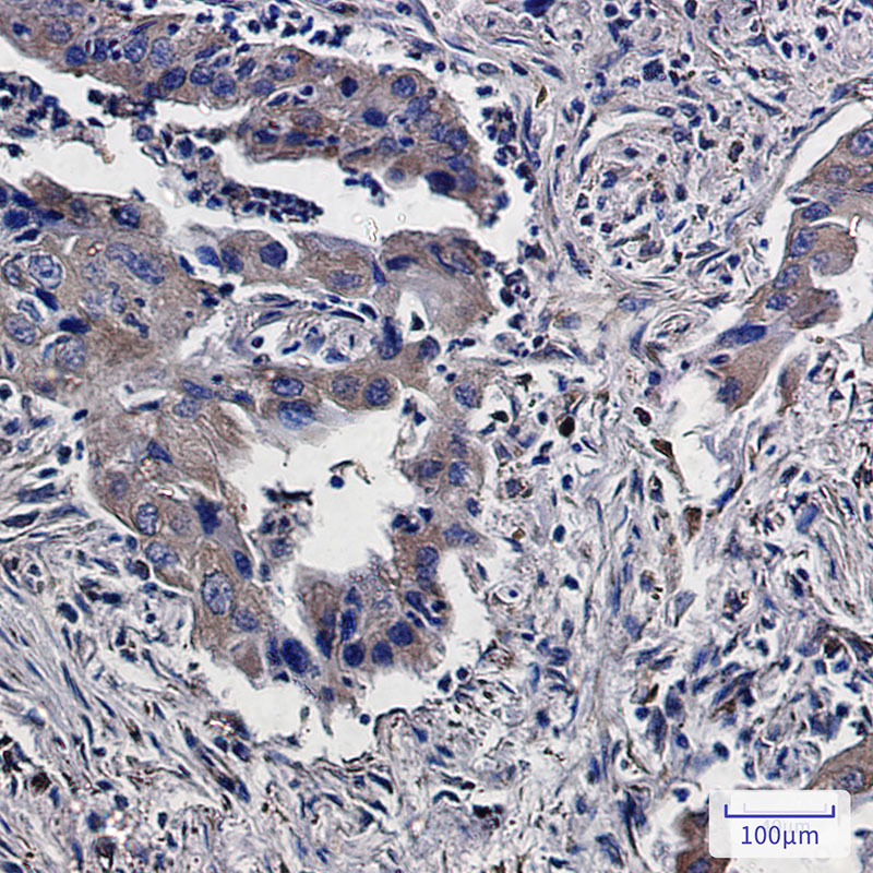 Rabbit Monoclonal Antibody to Lumican