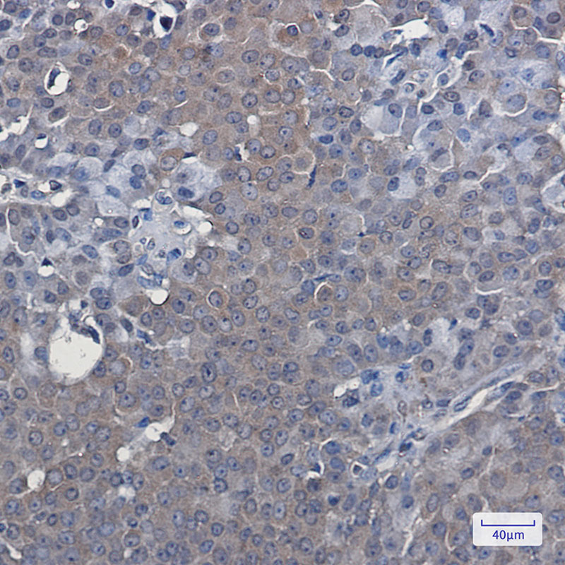 Rabbit Monoclonal Antibody to LXR alpha