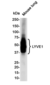 LYVE1